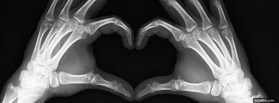 X-Ray Love facebook cover